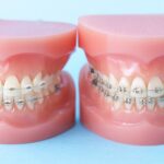 日本矯正歯科学会認定医とは？