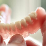 失った歯が蘇るオールオン４ってなに？