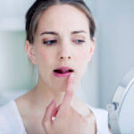 矯正中に着色汚れを予防！白い歯を維持しよう