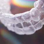 歯に歯石がついている！インビザライン矯正に影響はある？前編