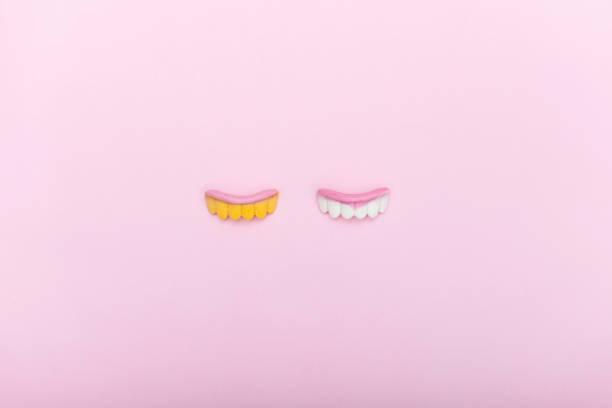 ウォーキングブリーチについて