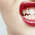 歯石がつきやすい人とは？