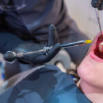 親知らずは抜いた方が良い？痛みはある？