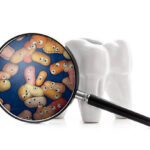 歯周病は顎の骨までも溶かすって本当？