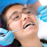 ワイヤー矯正の種類と治療費の相場