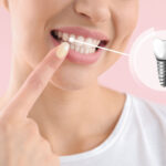 インプラントが向いている人はこんな人！