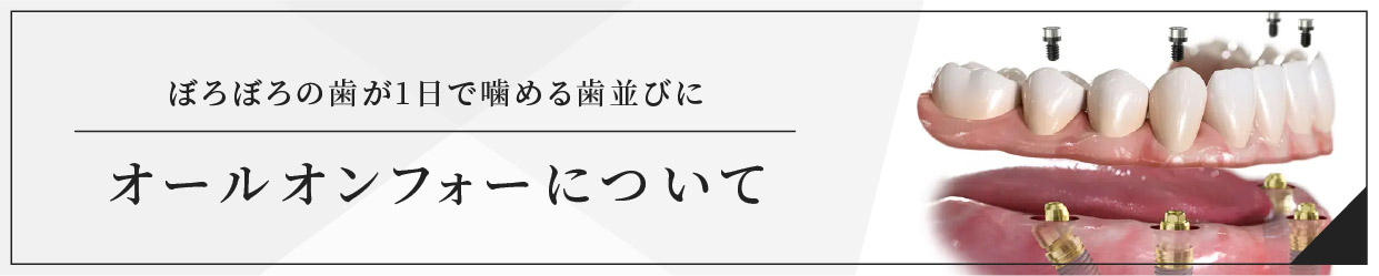 オールオンフォーについて