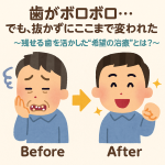 歯がボロボロ…でも、抜かずにここまで変われた 〜残せる歯を活かした“希望の治療”とは？〜