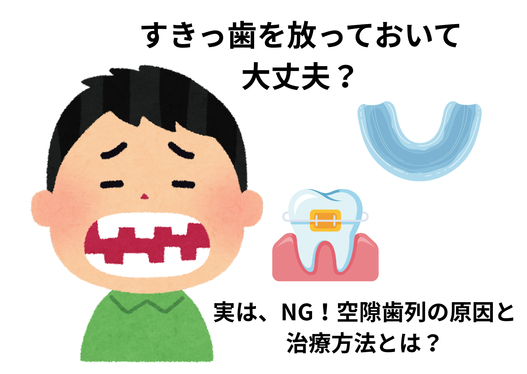 [すきっ歯を放っておいて大丈夫？]実はNG！空隙歯列の原因と治療方法とは？