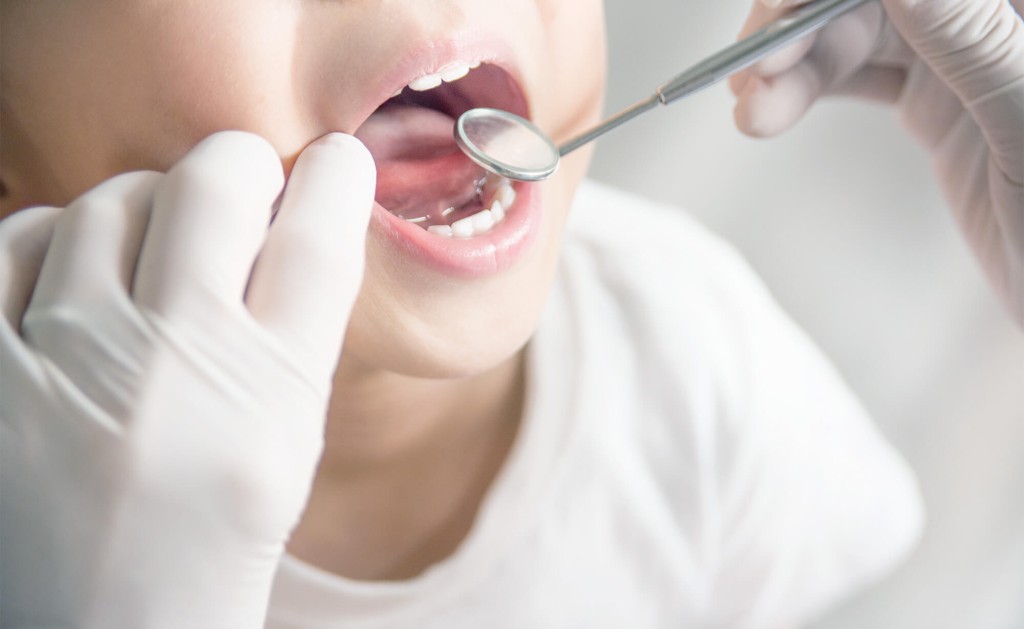 歯列矯正用咬合誘導装置について