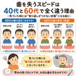 歯を失うスピードは40代と60代で全く違う理由 -気づいた時には“取り返しがつかない状態”になる前に-