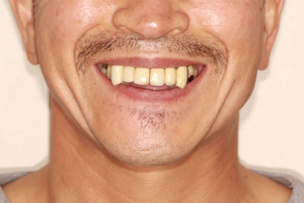 Before